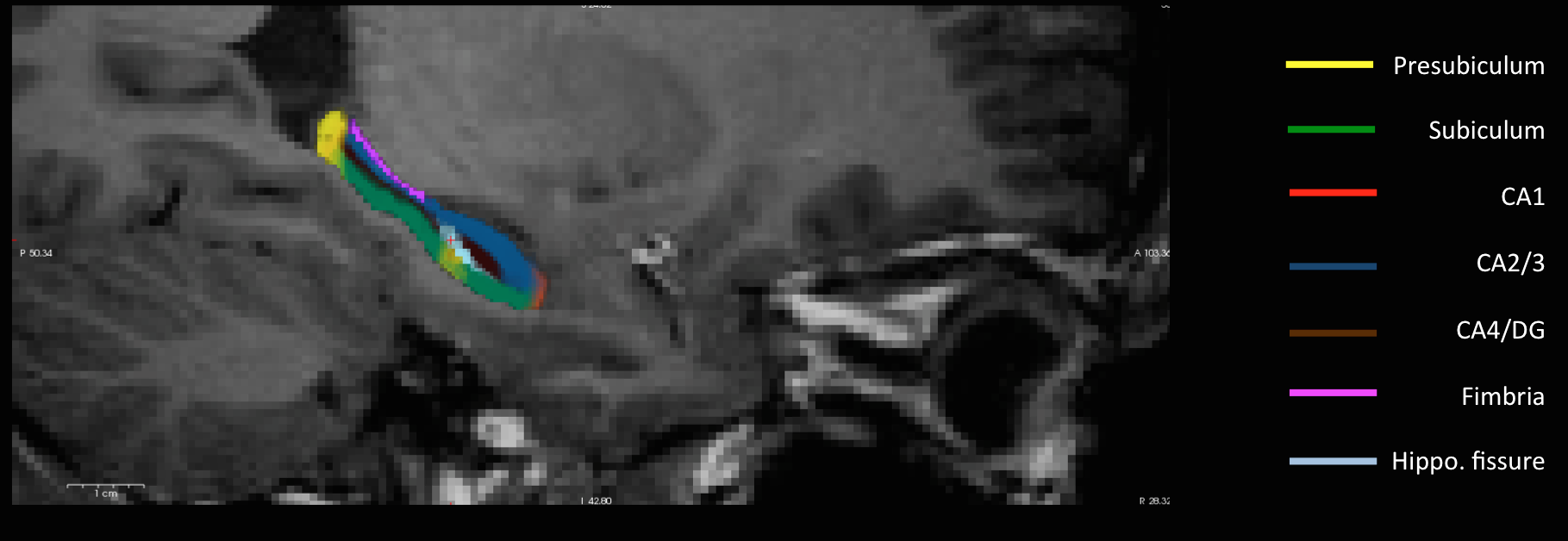 Ohbm Abstract Deadline 2025